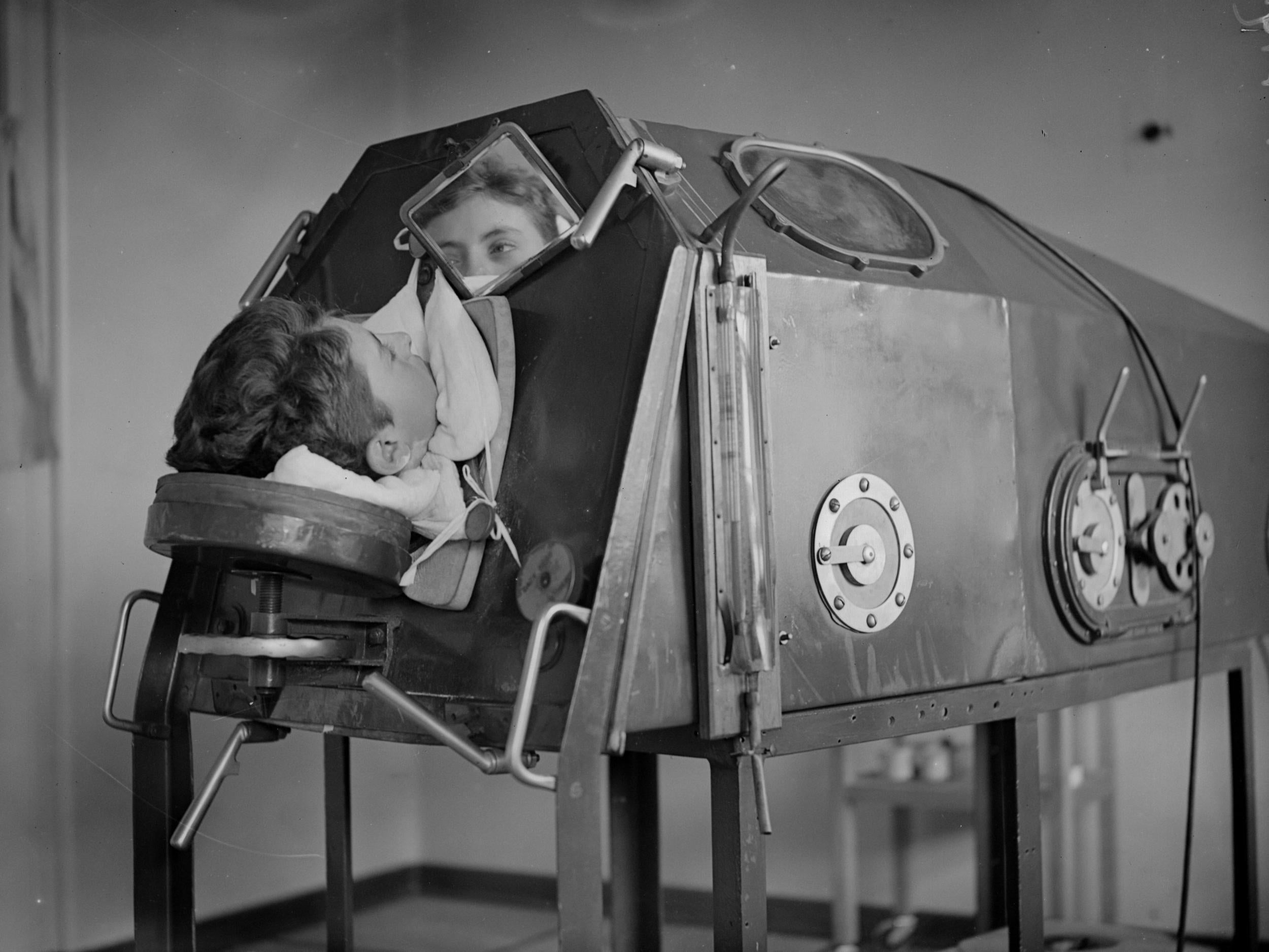 A polio patient in an iron lung in 1938 (Getty)