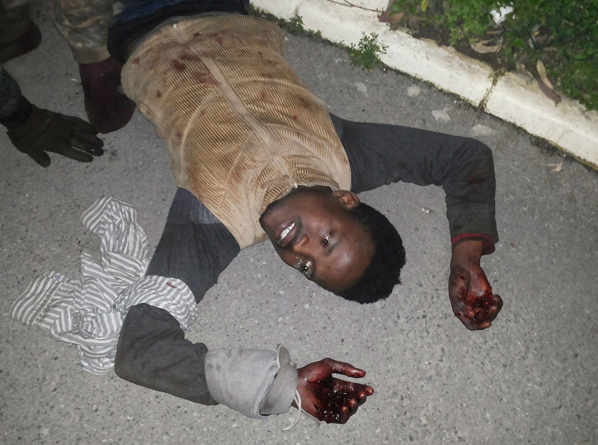 A migrant with wounded hands lies on the ground after climbing a barbed wire fence into the Spanish enclave of Ceuta on 17 February