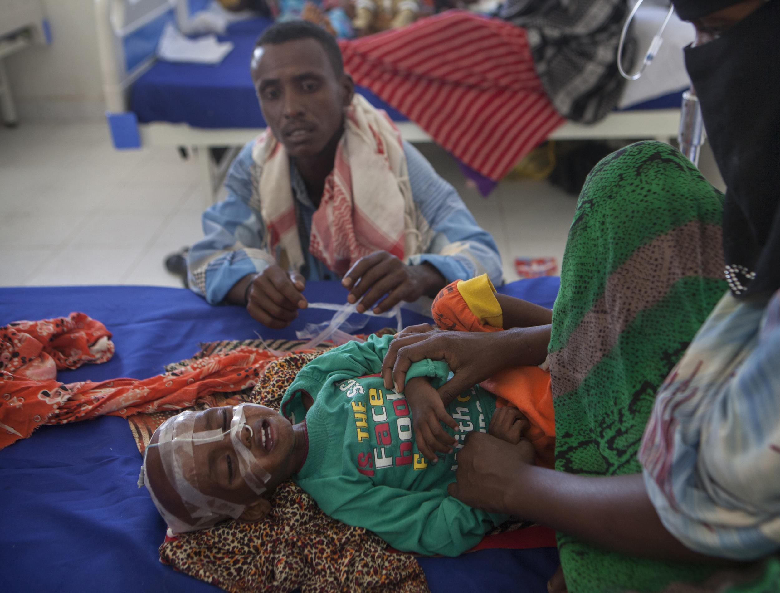 Mohamed’s child Abdifatax is being treated for severe malnutrition at a specialist clinic