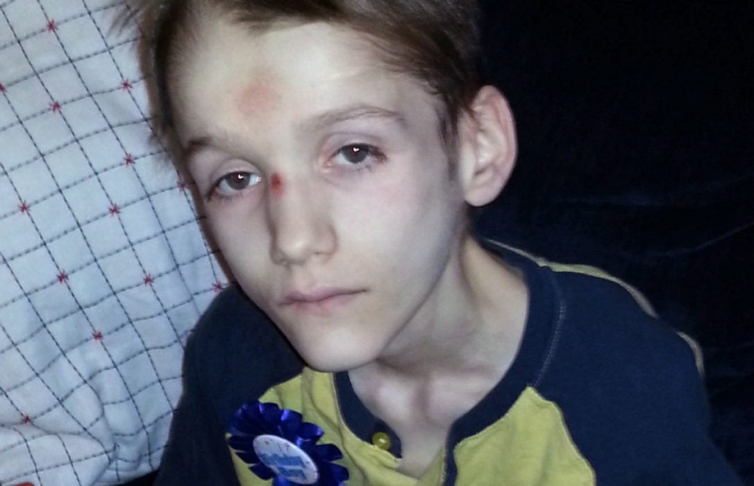 Alexandru, 15, died after suffering for years due to untreated diabetes and starvation