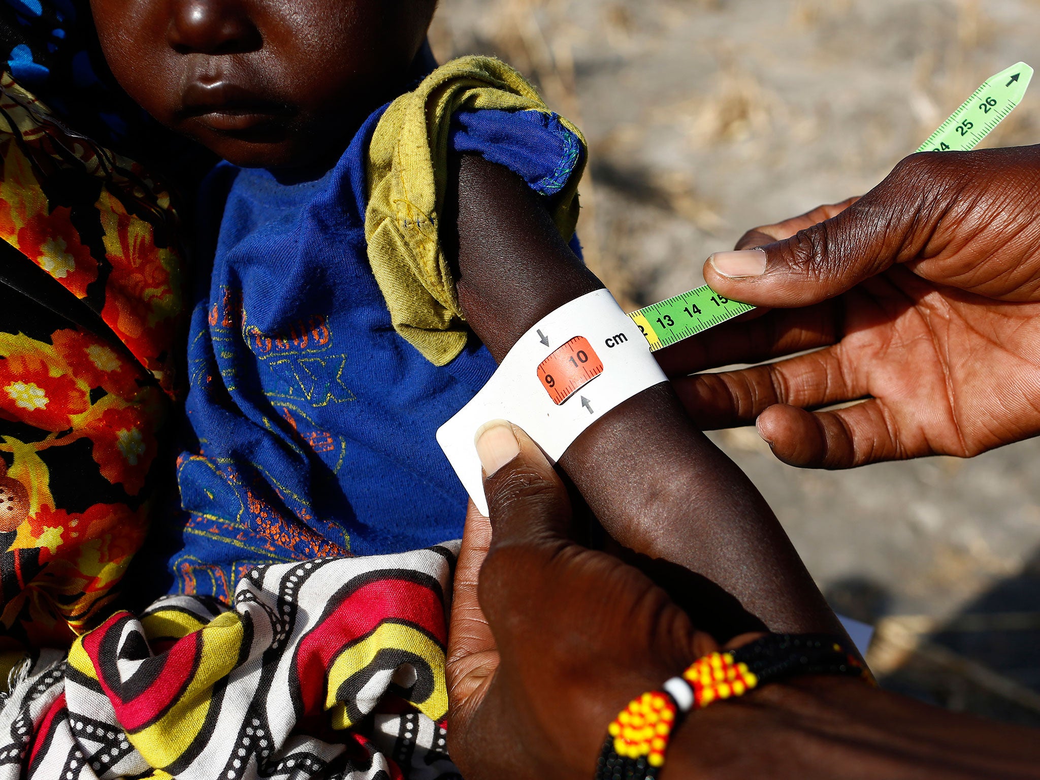 Two-year-old Nyalel Gatcauk has her arm measured by a Unicef nutrition worker