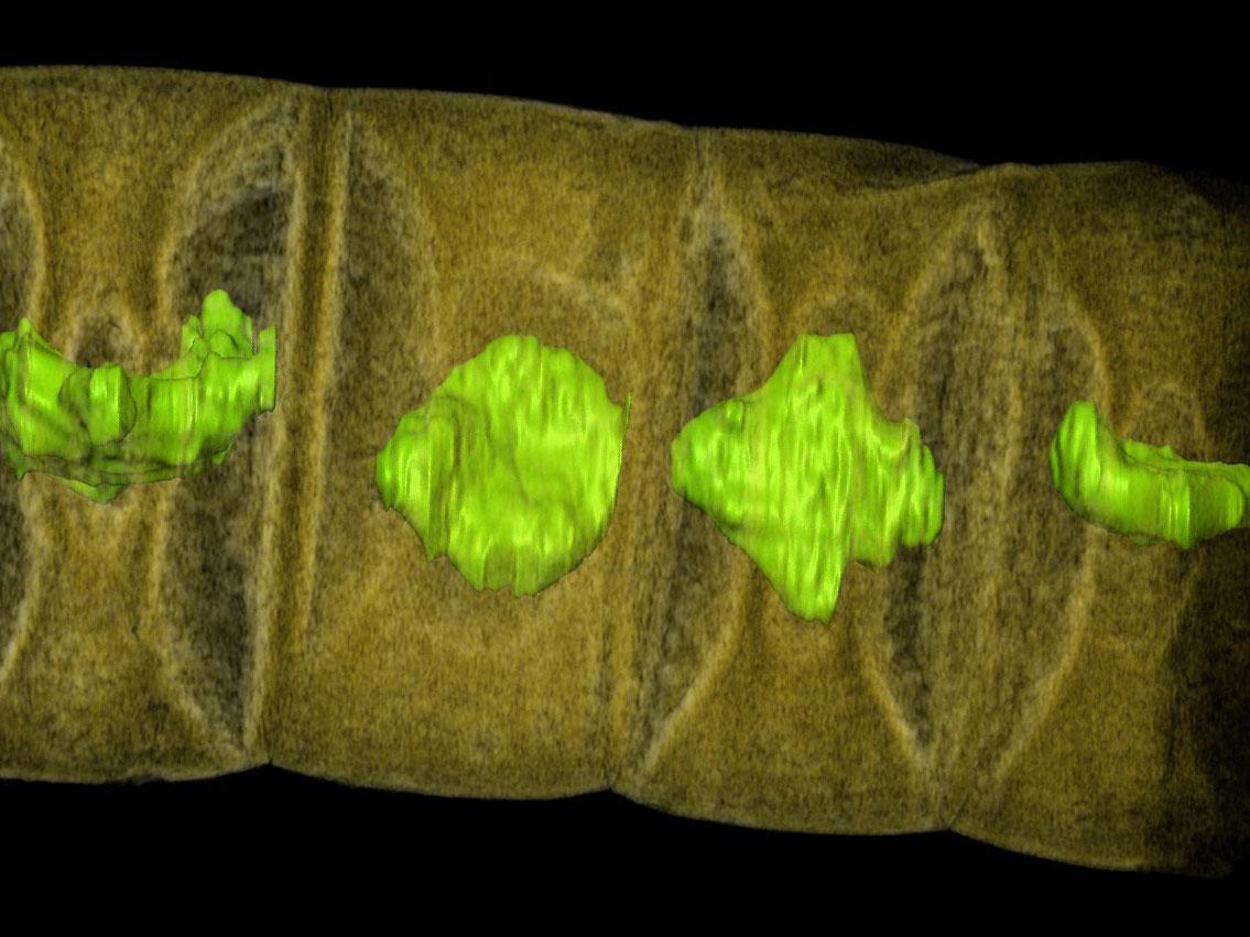 An X-ray image of fossilised red algae, highlighted in green