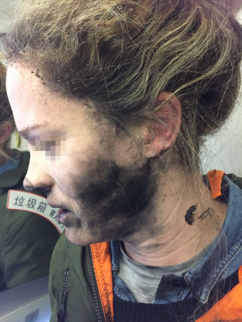 The passenger suffered burns to her face, neck and hands