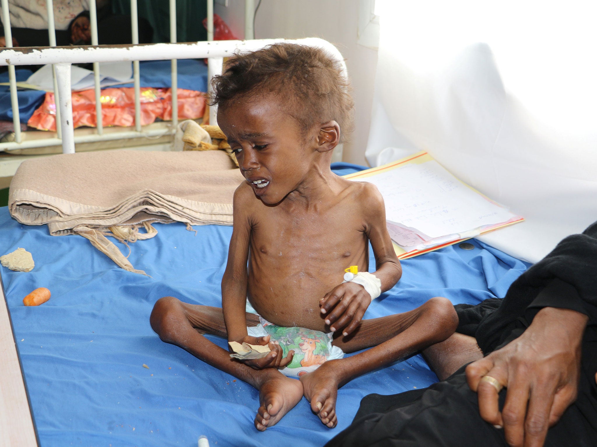 As many as 460,000 children face severe malnutrition in Yemen and 70 per cent of the population struggle to feed themselves (Reuters)