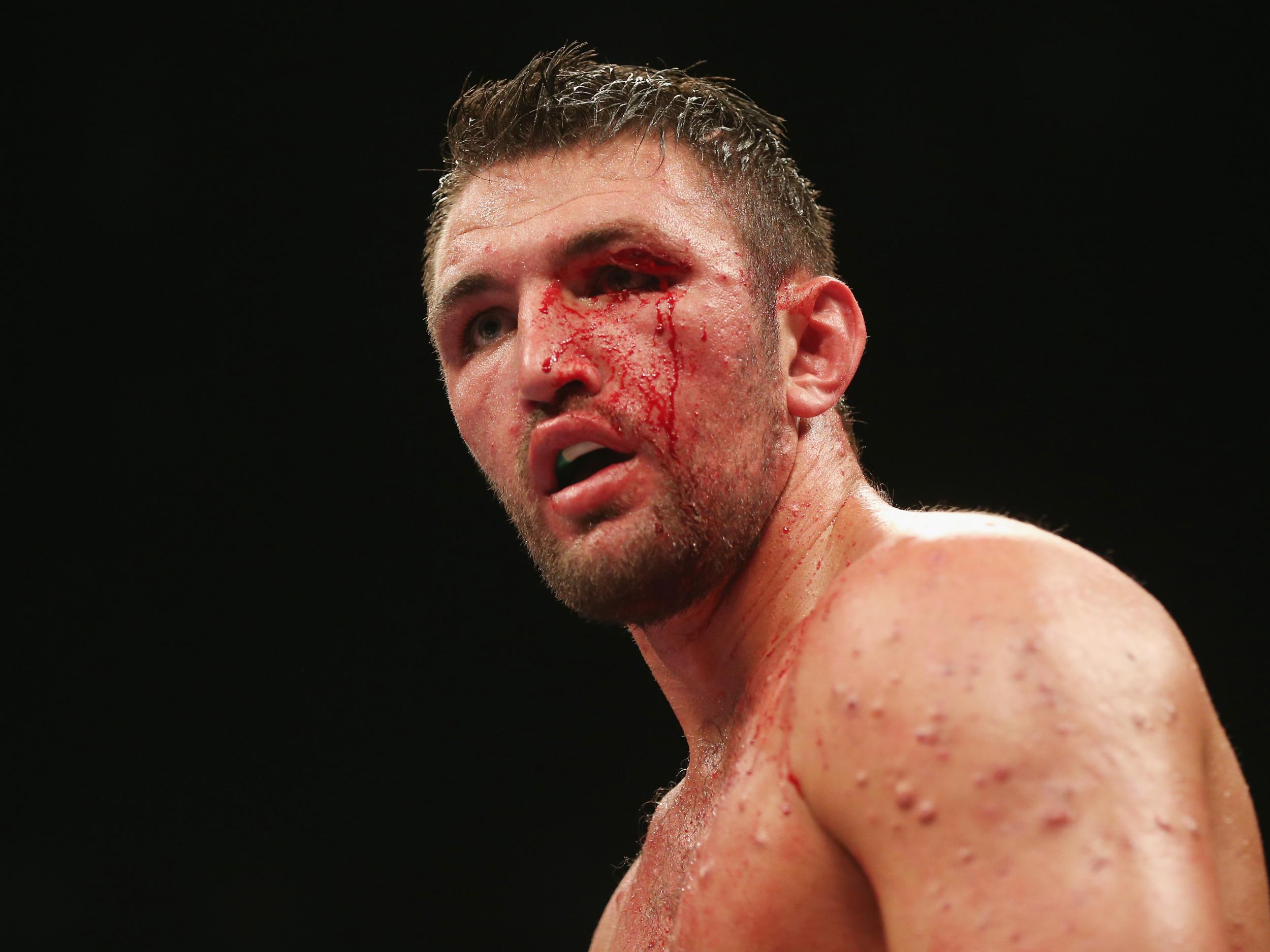 Hughie is unable to fight WBO champion Parker