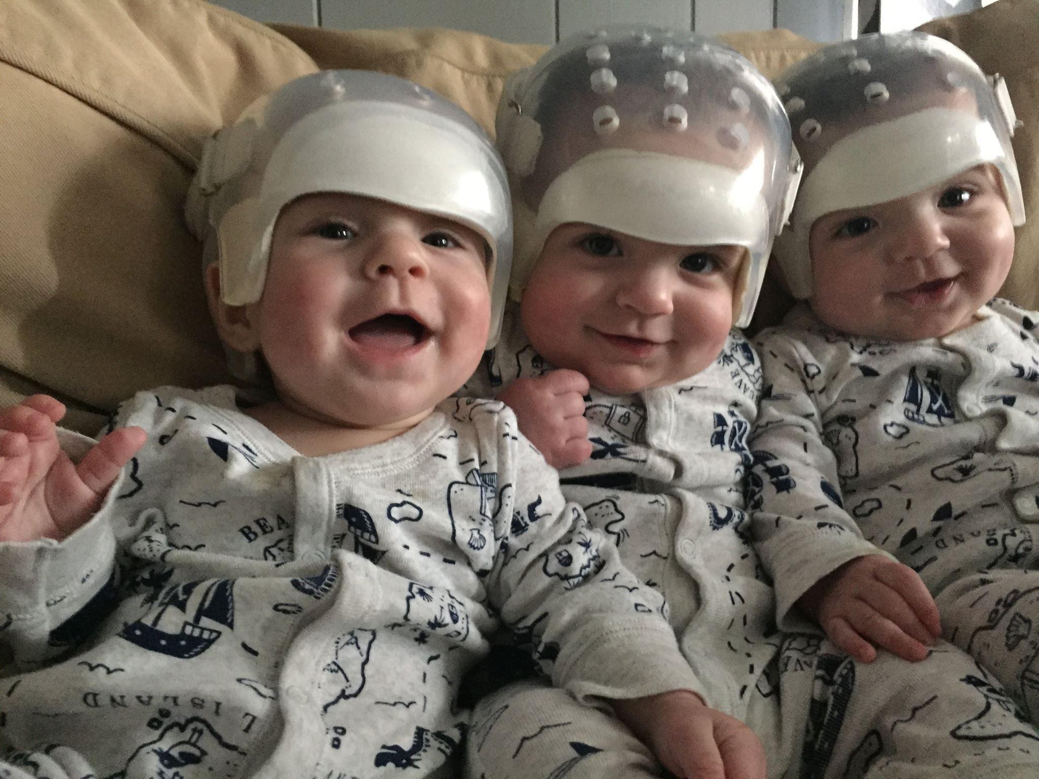 Jackson, Hunter, and Kaden Howard were all born with a rare skull disorder and underwent surgery at just 11 weeks old