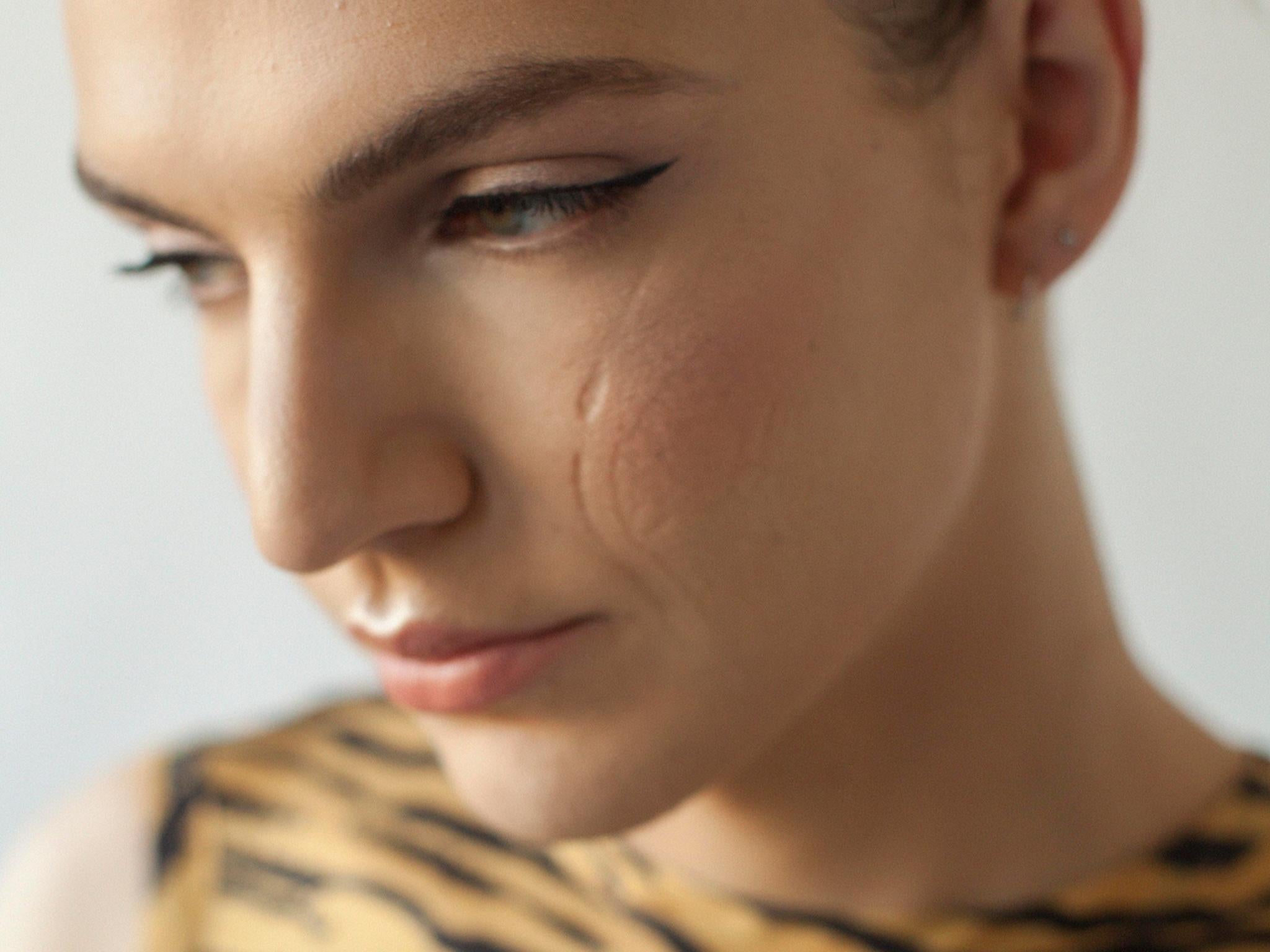 Sophie Mayanne is inviting people to bare their scars on camera