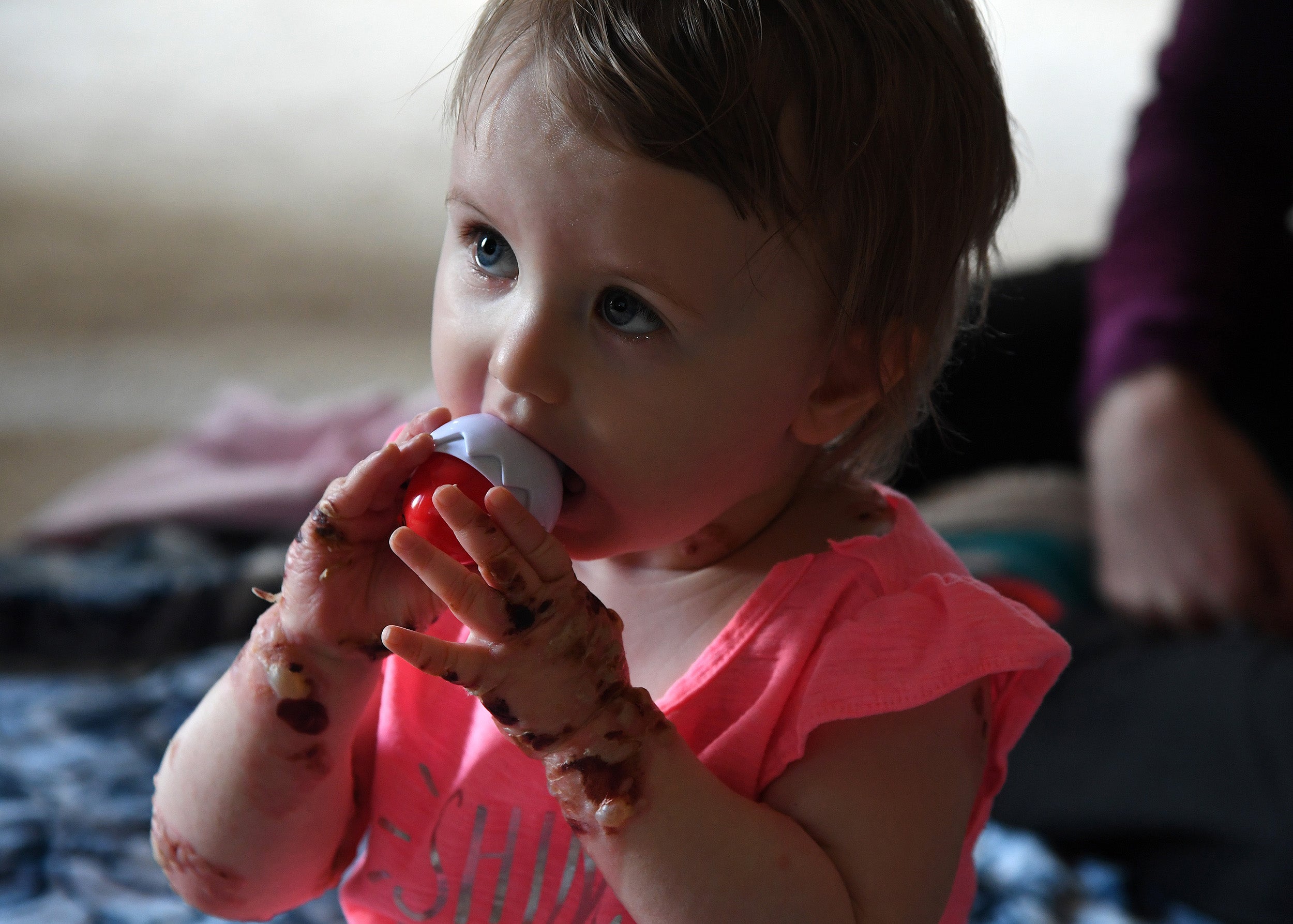 Baby Elizabeth’s epidermolysis bullosa is caused by a rare genetic fluke