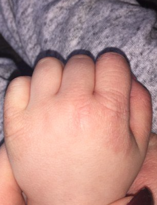 To her amazement baby Evie’s eczema had cleared up within a week thanks to the 'miracle' cream (Image: Paige Sweeney)