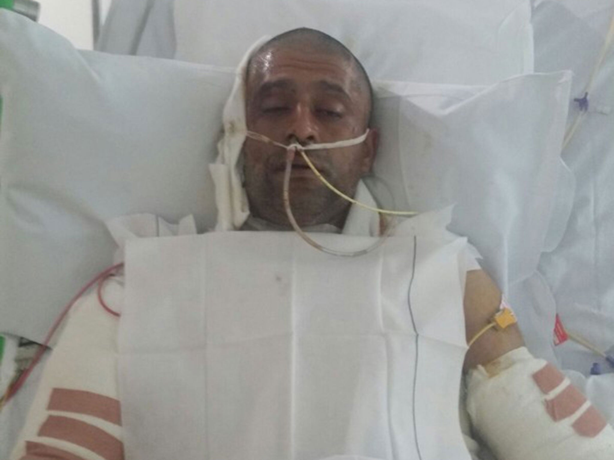 Jameel Muhktar, 37, in hospital following an acid attack on 21 June