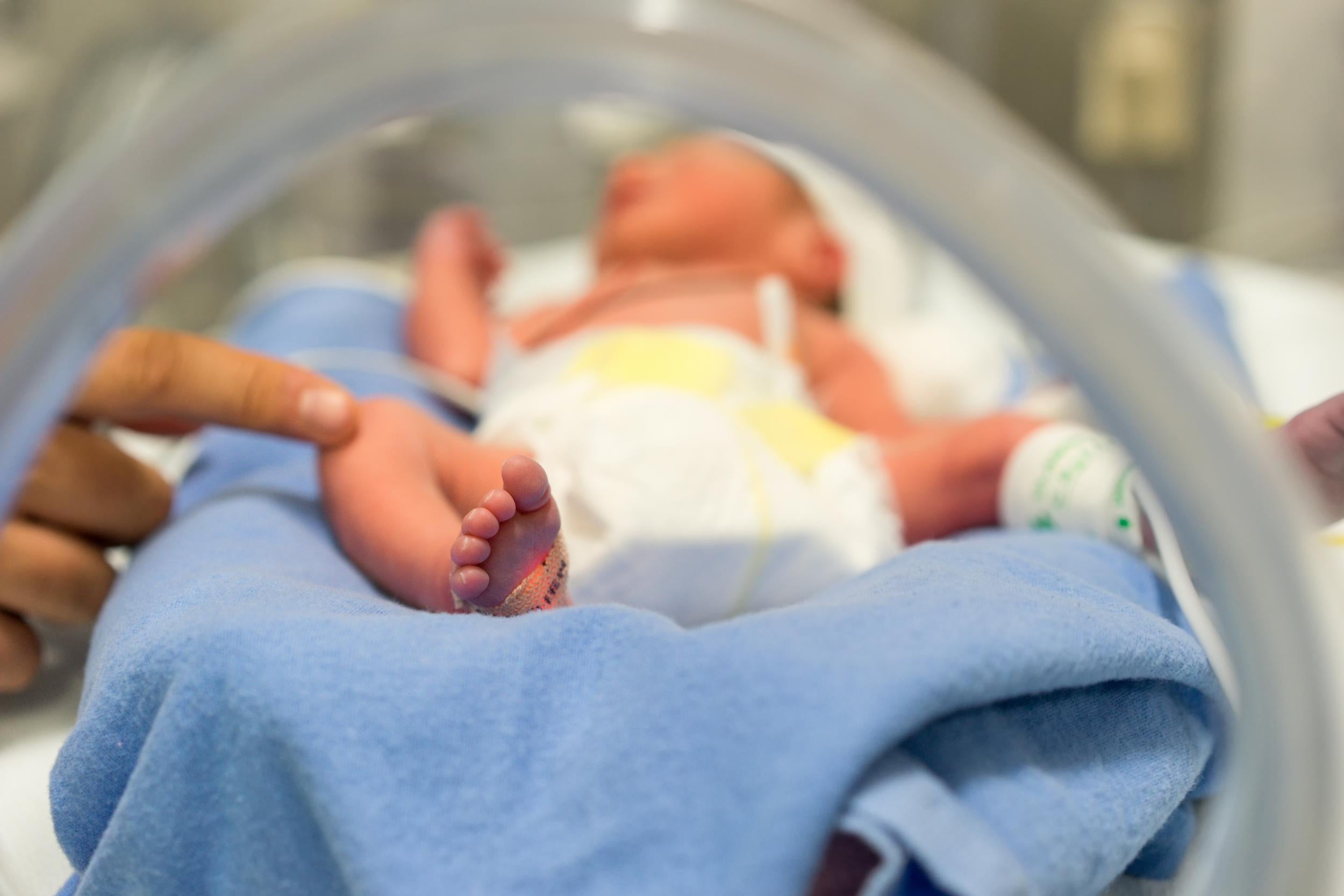 Premature birth affects 15 million infants a year and is the leading cause of neonatal death in developed countries