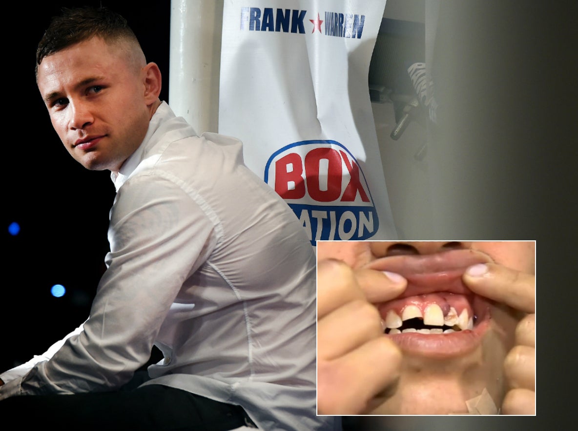 Frampton will no longer be fighting on Saturday night