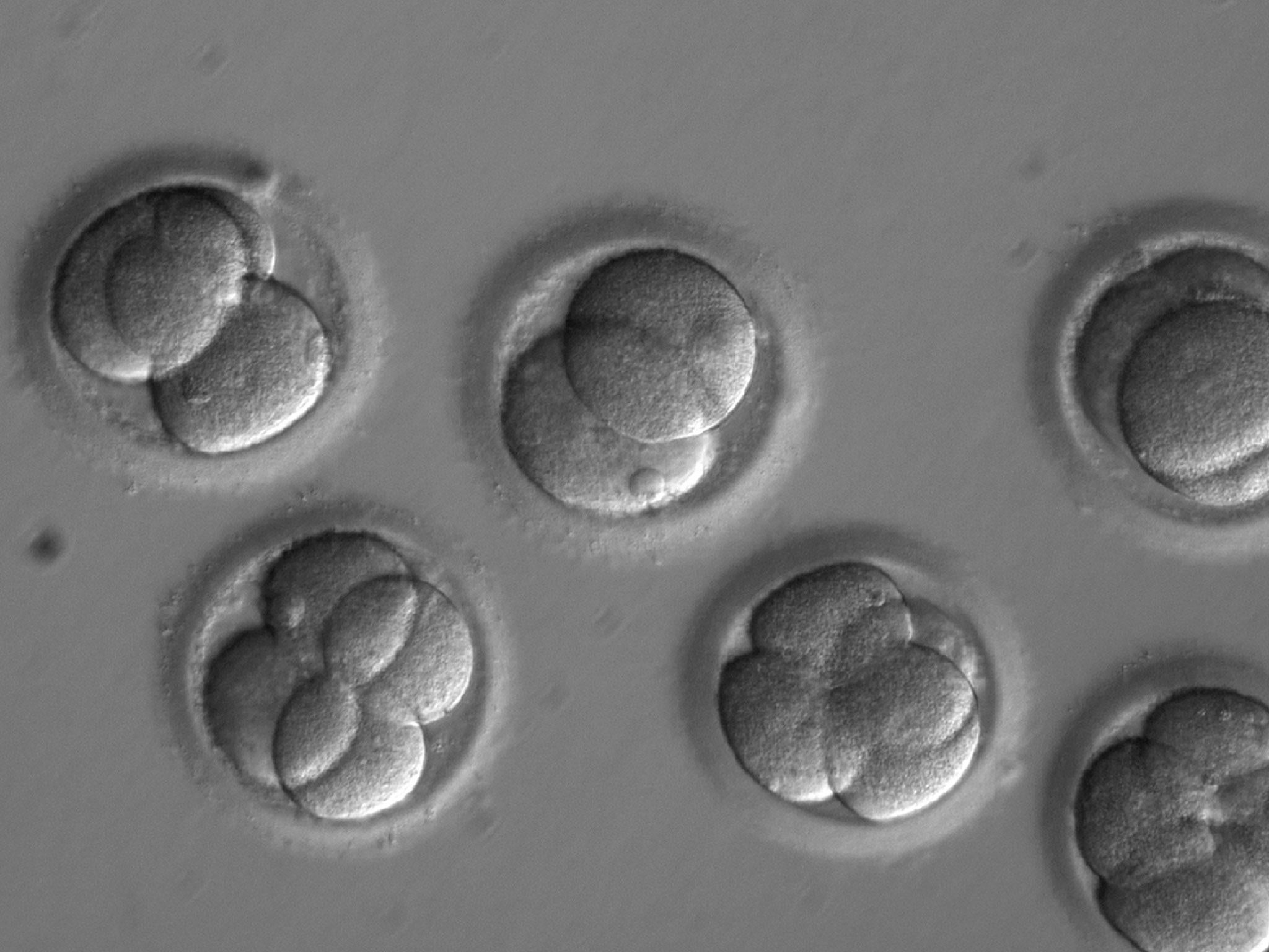 Individual cells days after injection