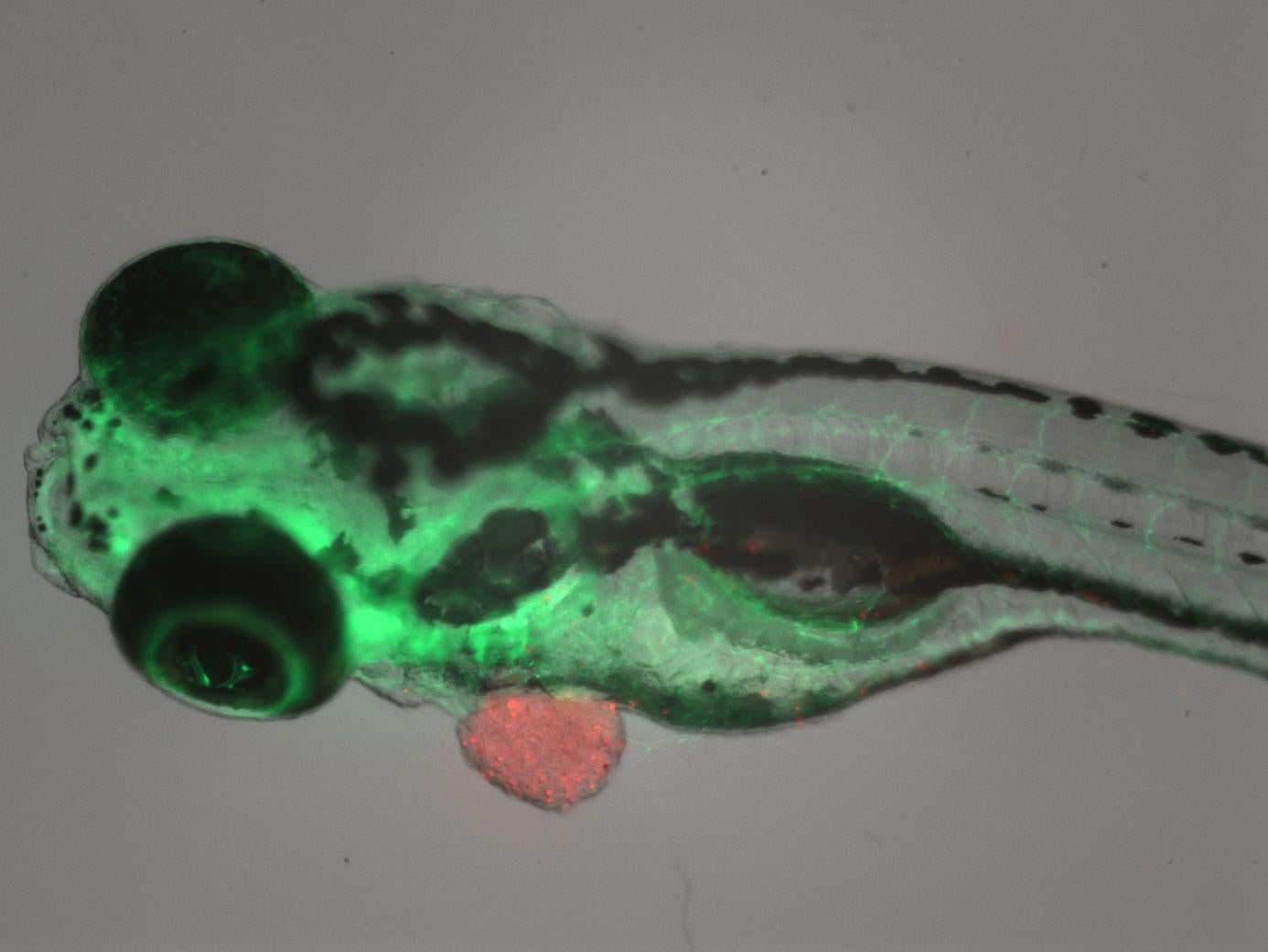 A zebrafish with a tumor from a cancer patient