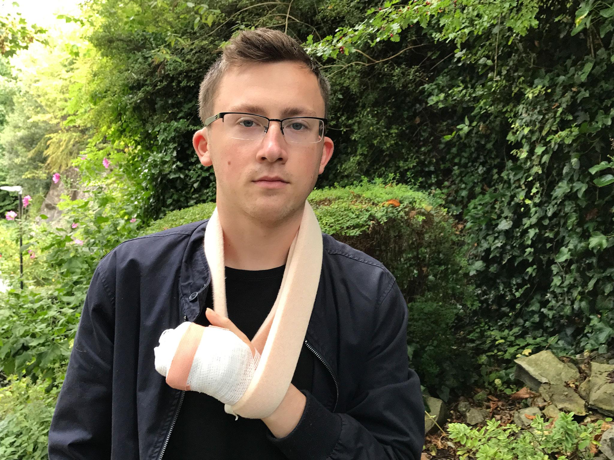 Anthony Seward, 21, had his hand crushed in a mangle in a work accident