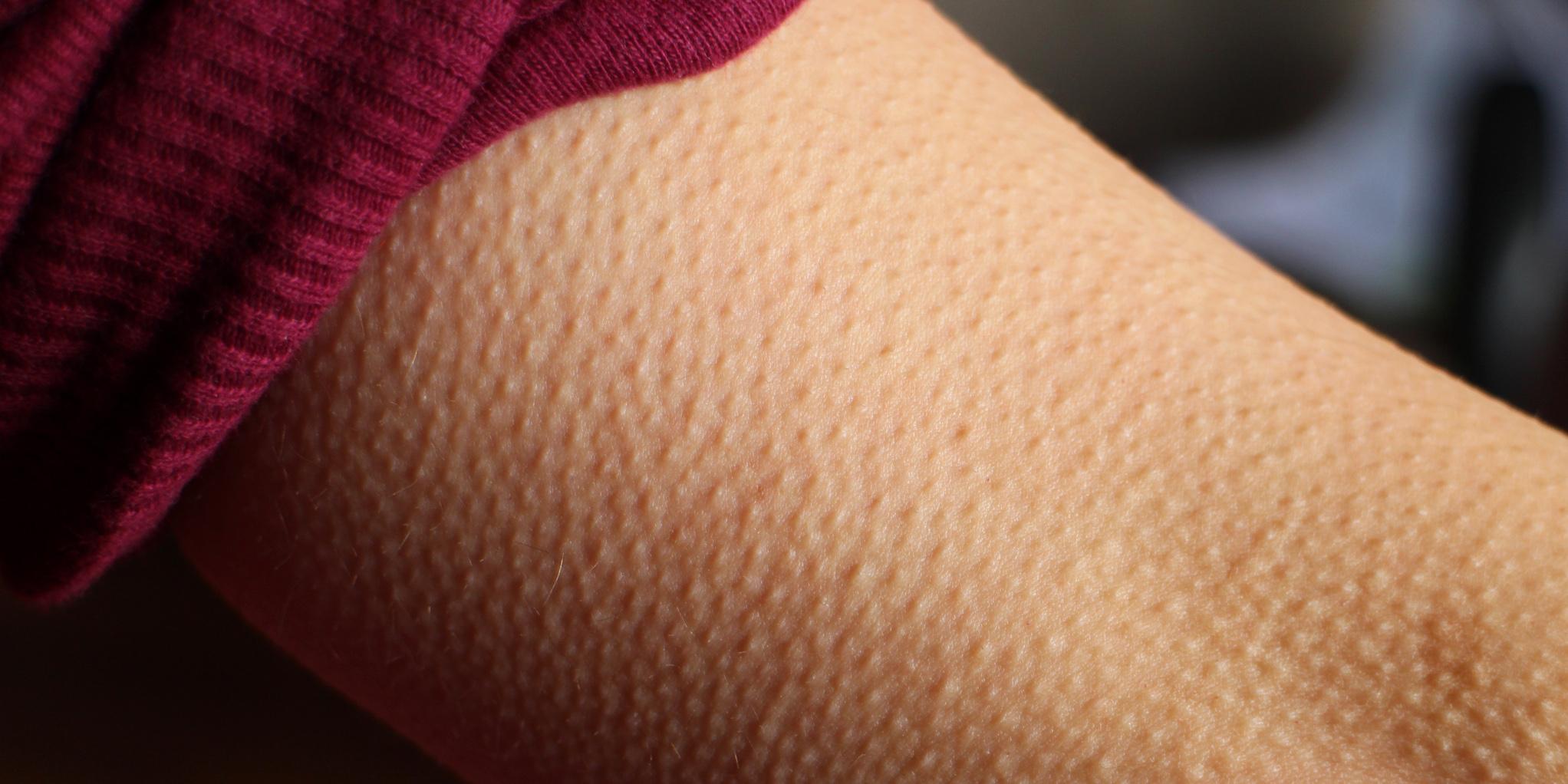 Goosebumps are the result of tiny muscles flexing in the skin, making hair follicles rise up slightly