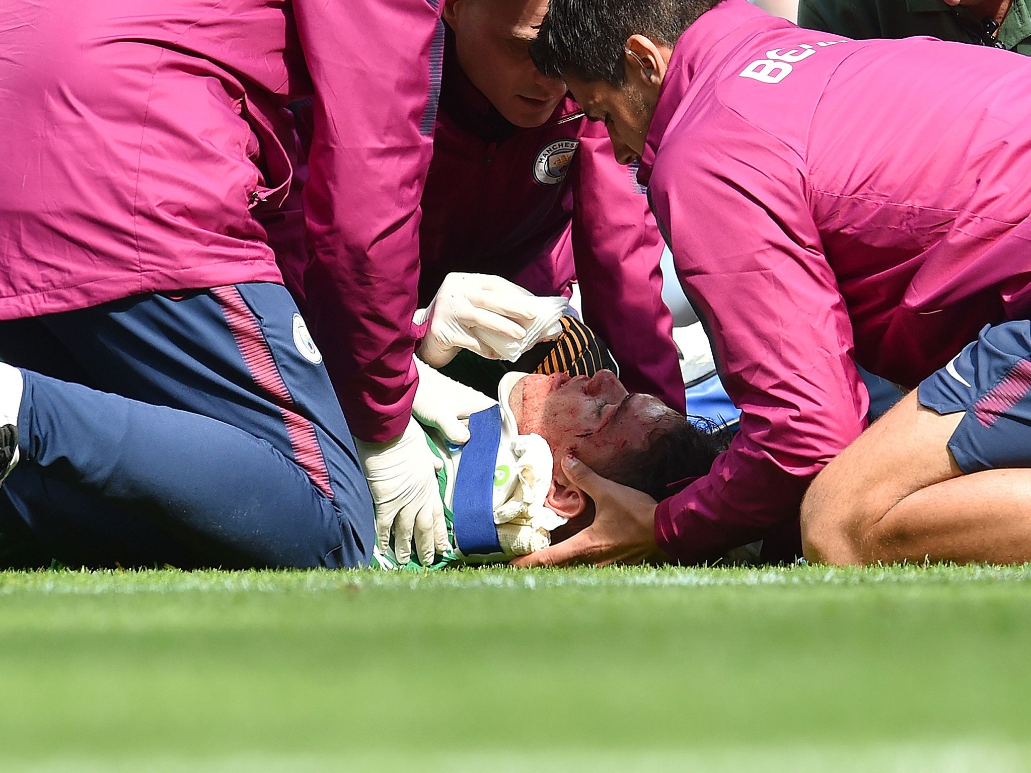 Ederson receives on-pitch treatment after being caught in the face by Mane's high boot