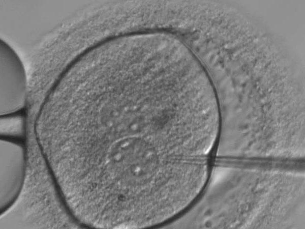 An embryo is injected with the Crispr/Cas9 gene-editing components