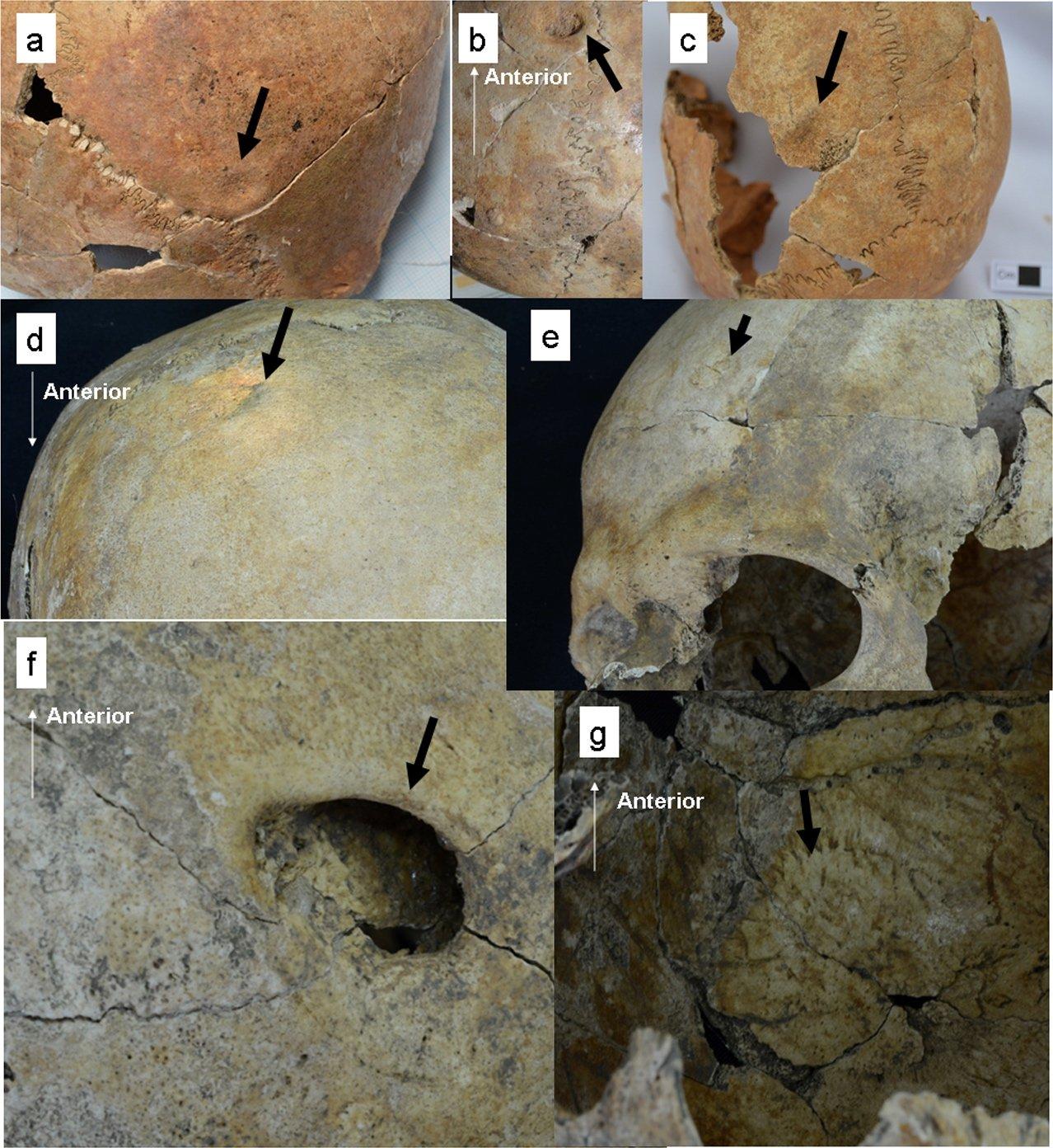 (Nagaoka et al, PLoS One, 2017