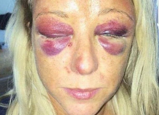 Sarah Wheatley was rushed to hospital after being brutally beaten by Russell Mason