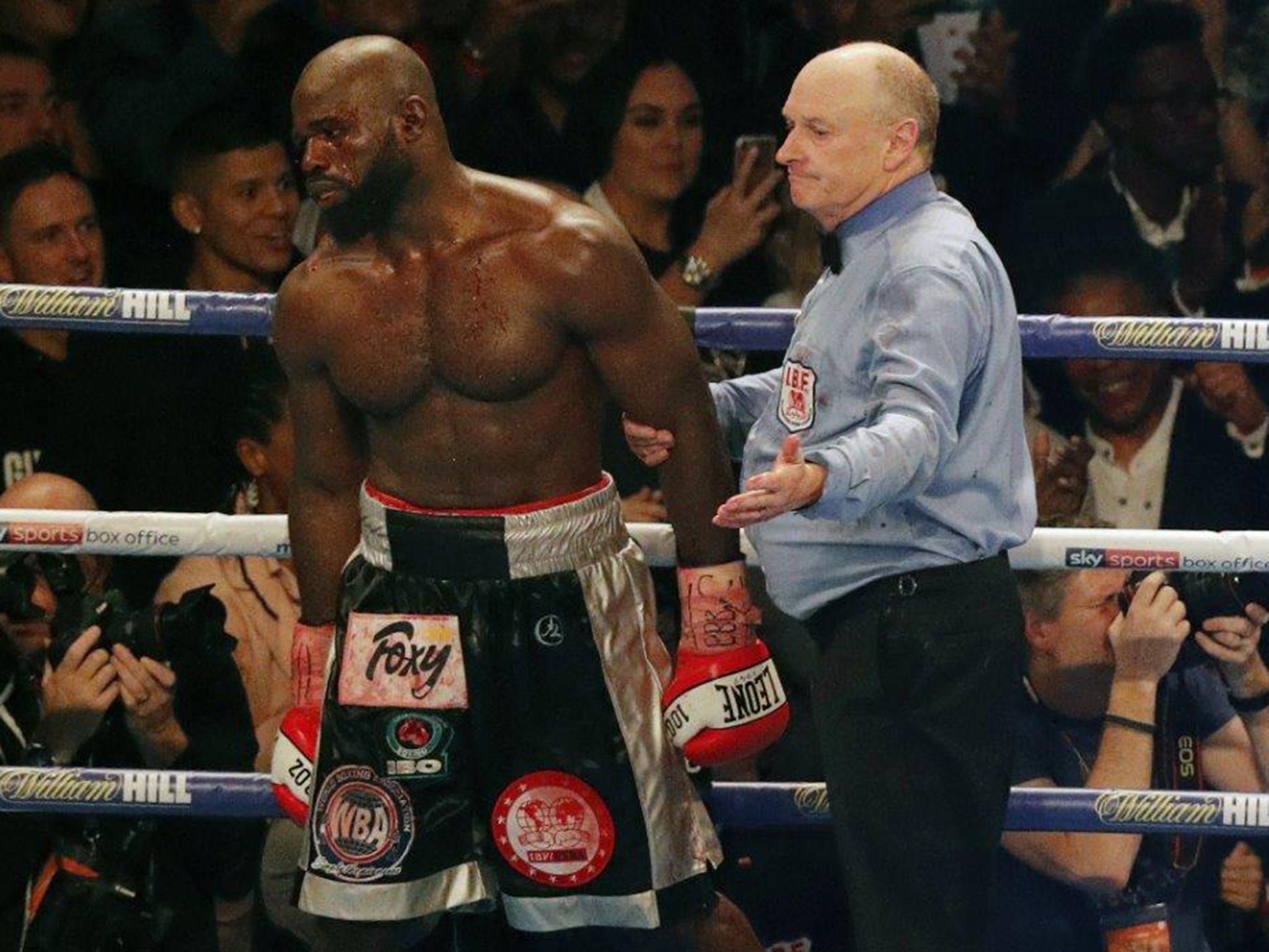 Takam was visibly frustrated with the stoppage and called for a rematch