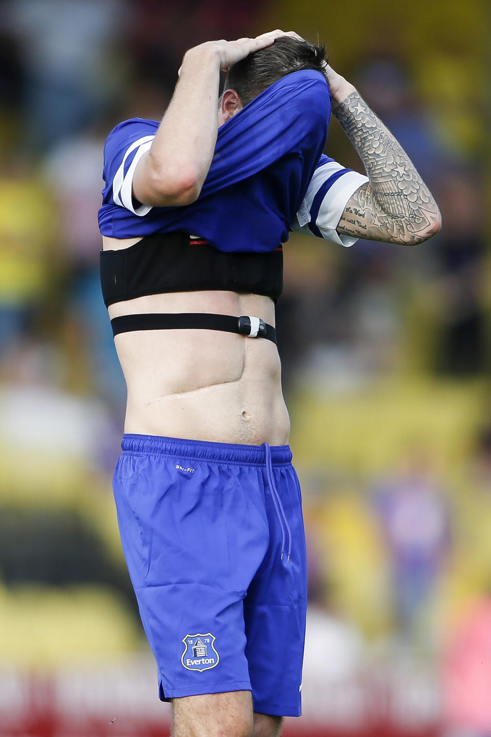 Duffy was lucky to survive the clash, which left a six-inch scar