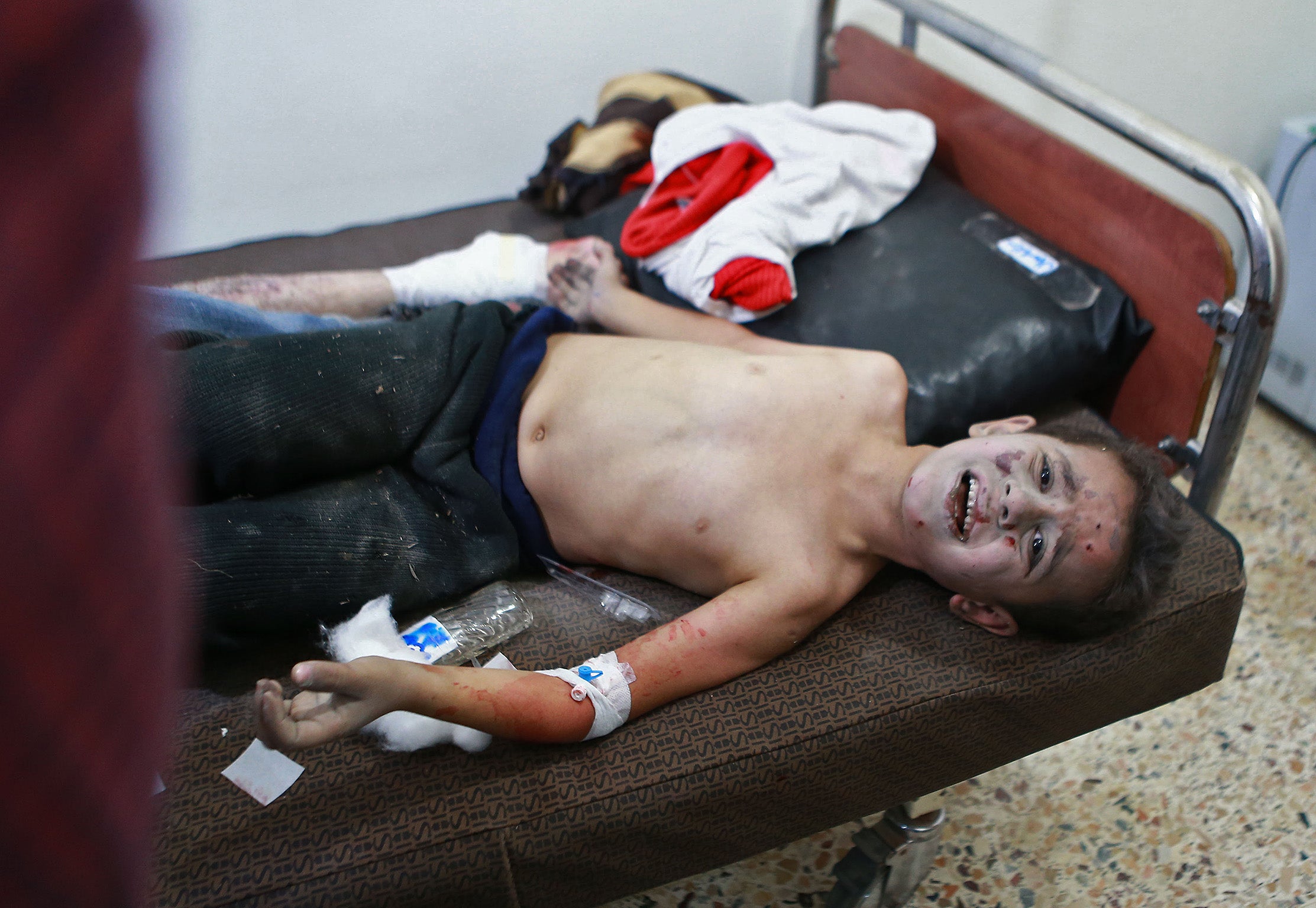 A Syrian boy receives treatment for his wounds in a hospital following a reported air strike in the rebel-held besieged town of Arbin