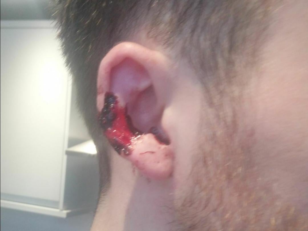 The man was attacked during an argument about a loud phone conversation