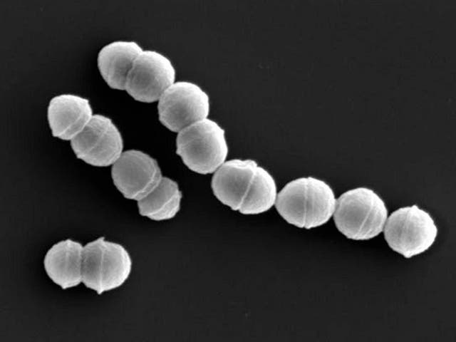 <p>Over 1,000 cases of streptococcal toxic shock syndrome (STSS) were reported in Japan in the first six months of 2024. The disease is predominantly caused by a bacterium named Streptococcus pyogenes (pictured) </p>