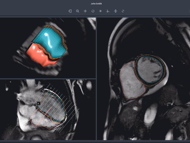 A programme built by Arterys can perform an MRI in just 15 seconds, compared to 45 seconds by a human