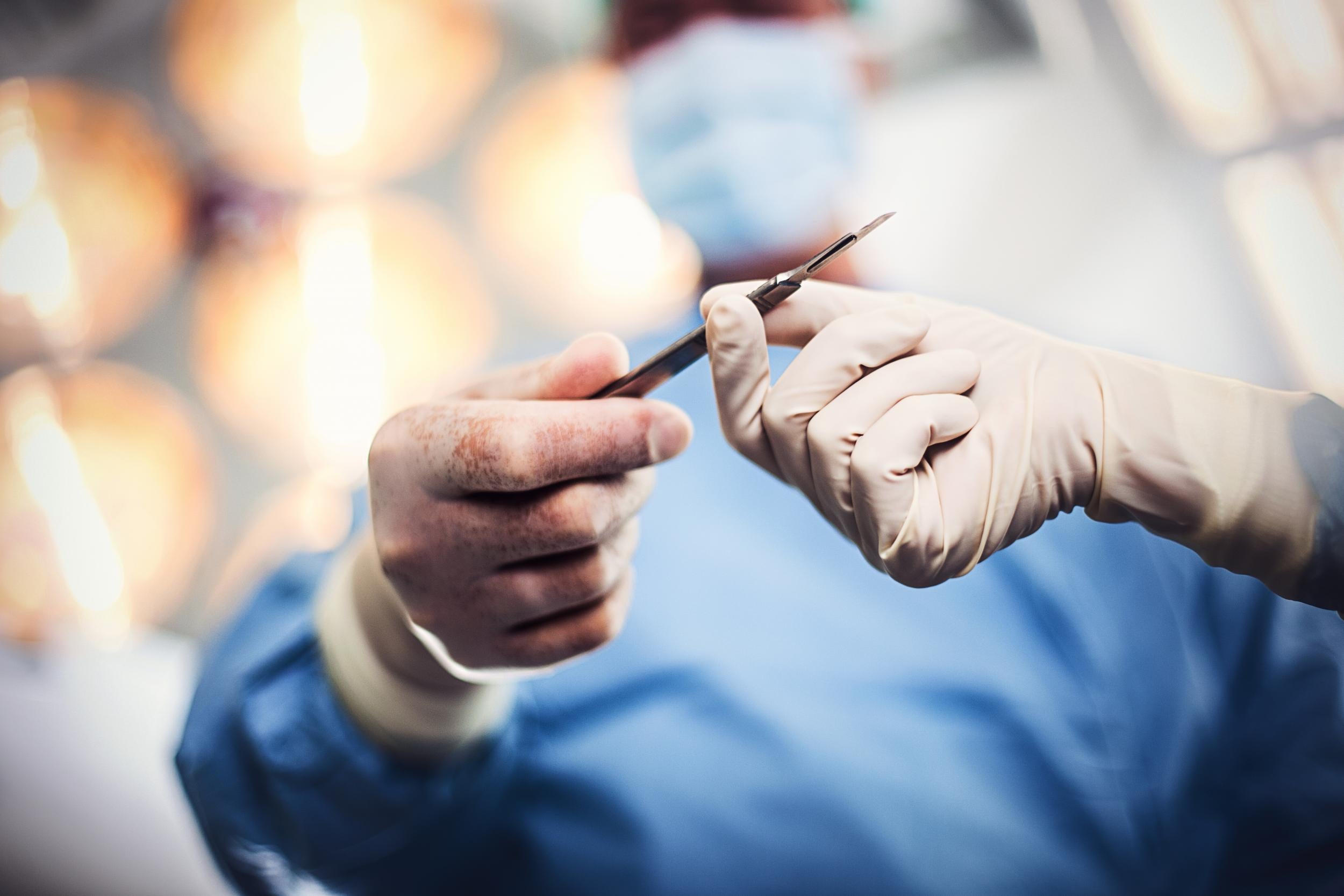 The procedure involves cutting a wedge out of the earlobe