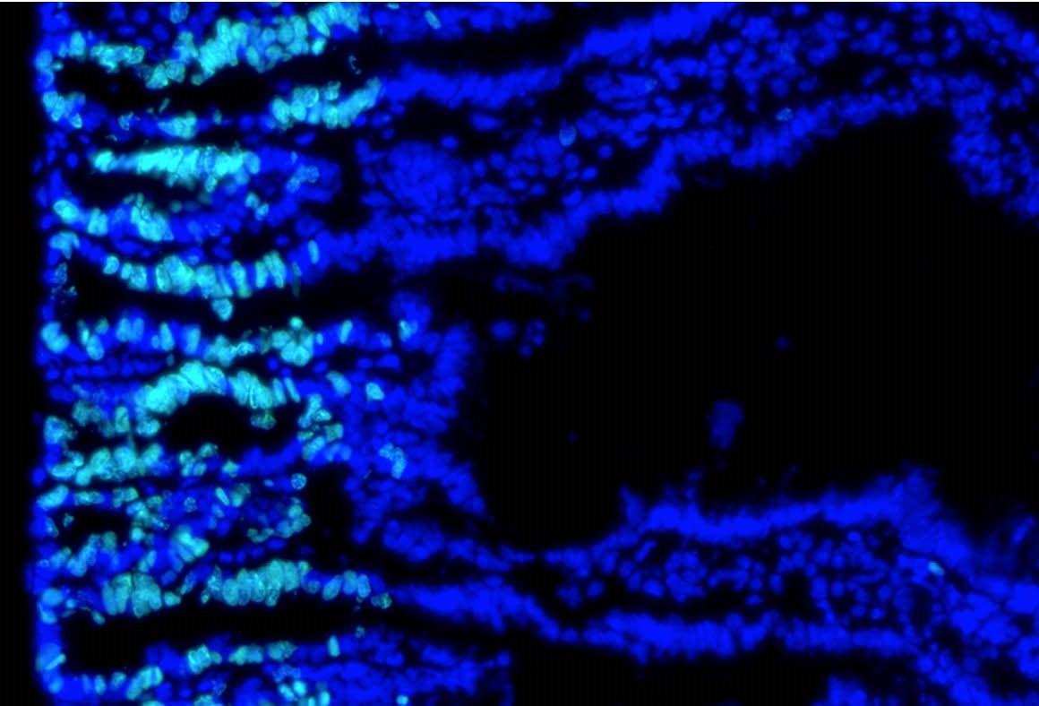 Scientists witnessed stem cells multiplying in the intestines in response to dietary cholesterol, increasing tumour growth ‘100-fold’