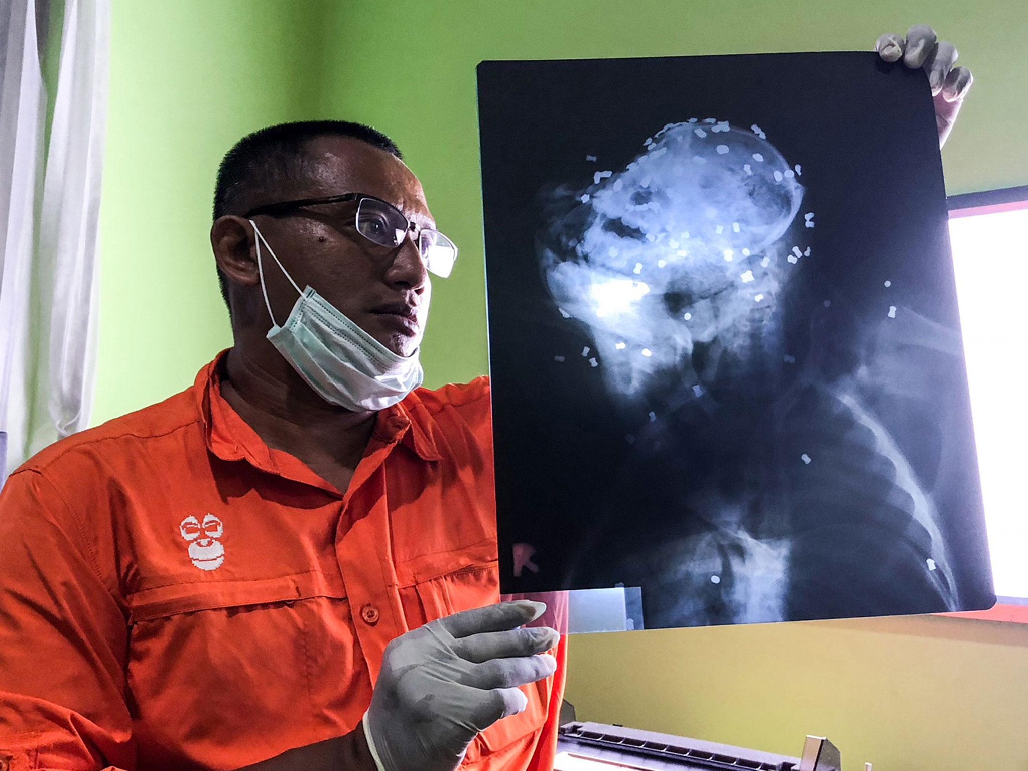 Hardi Baktiantoro, principal of the Centre for Orangutan Protection (COP), holds an x-ray showing air rifle pellets lodged in the head and body of the orangutan during its autopsy in East Kalimantan, Indonesia