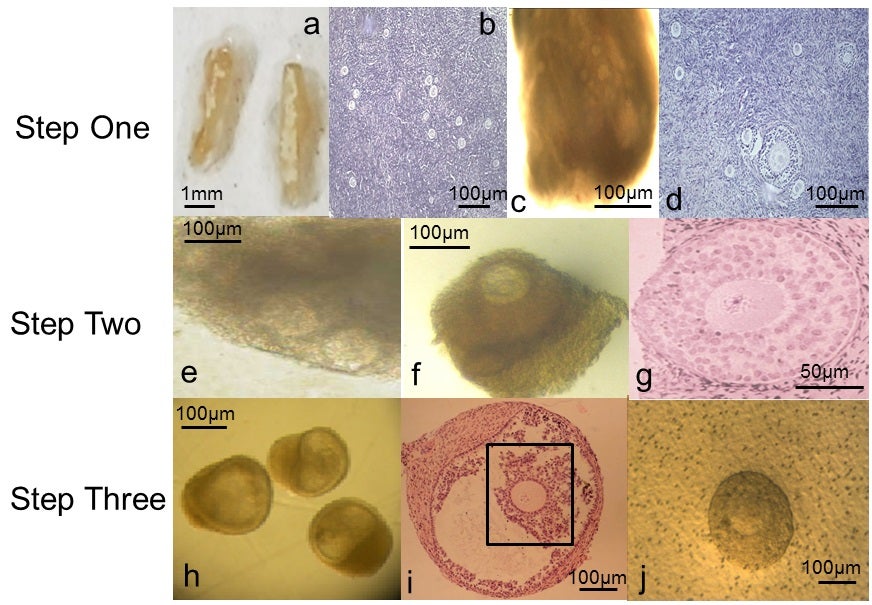 Step one: very small, immature human eggs within ovarian tissue are placed in culture in the lab, and begin to develop; Step two: after initial development, eggs have grown and are more than double their initial size. The ovarian follicles that contain the eggs are separated before further growth and monitoring; Step three: eggs and their surrounding cells are removed from liquid culture to undergo further development in a nutrient-rich membrane