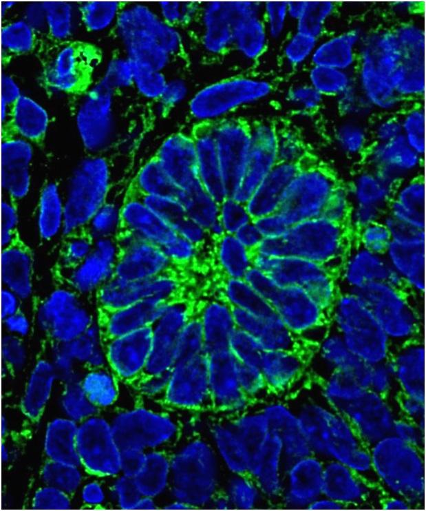 Cross section of a functioning nephron grown by the team