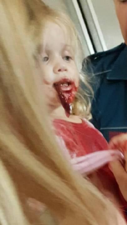 Evie began to vomit up blood and a blood clot post-tonsillectomy (Danna Davidson)