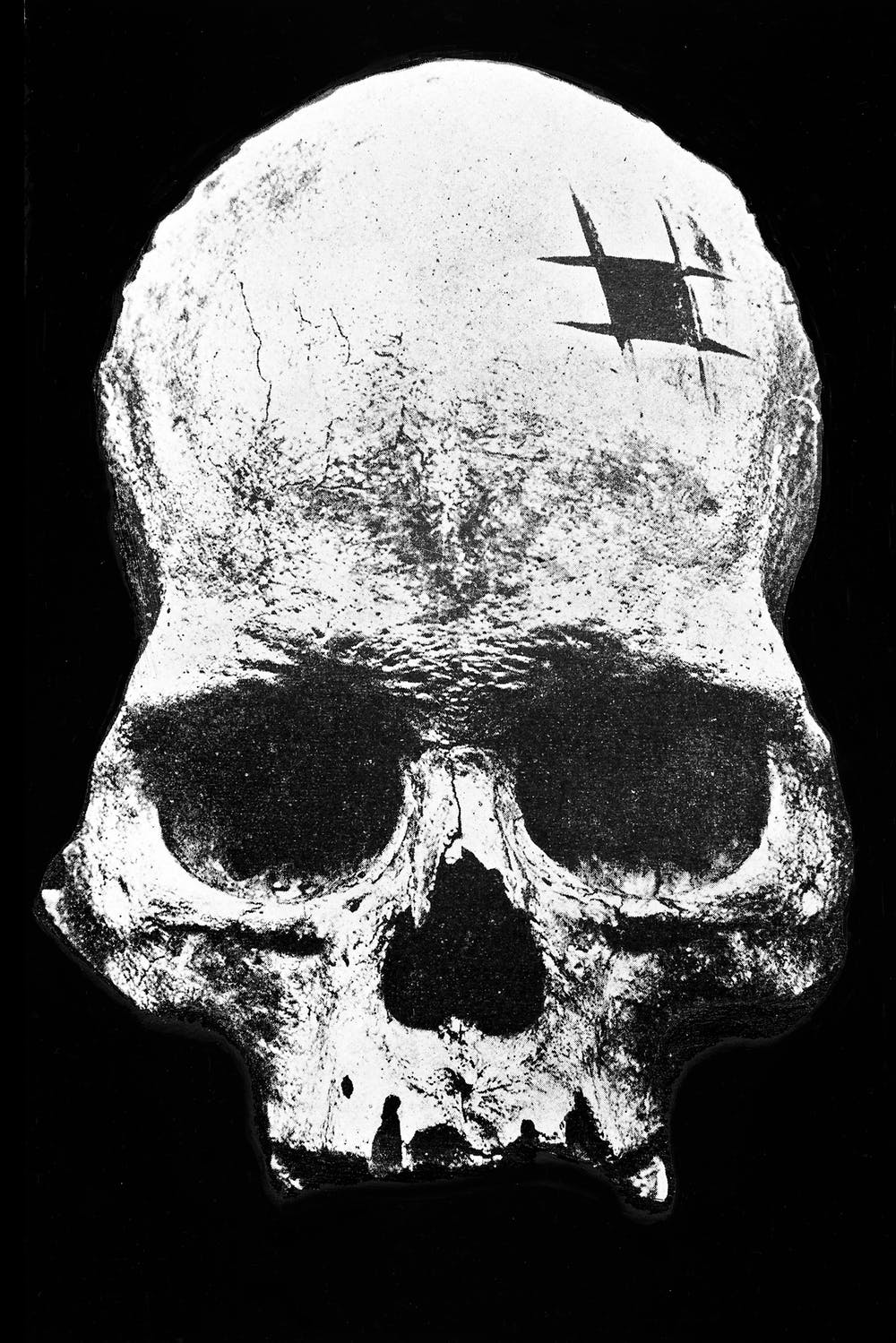 Inca skull showing trepanning