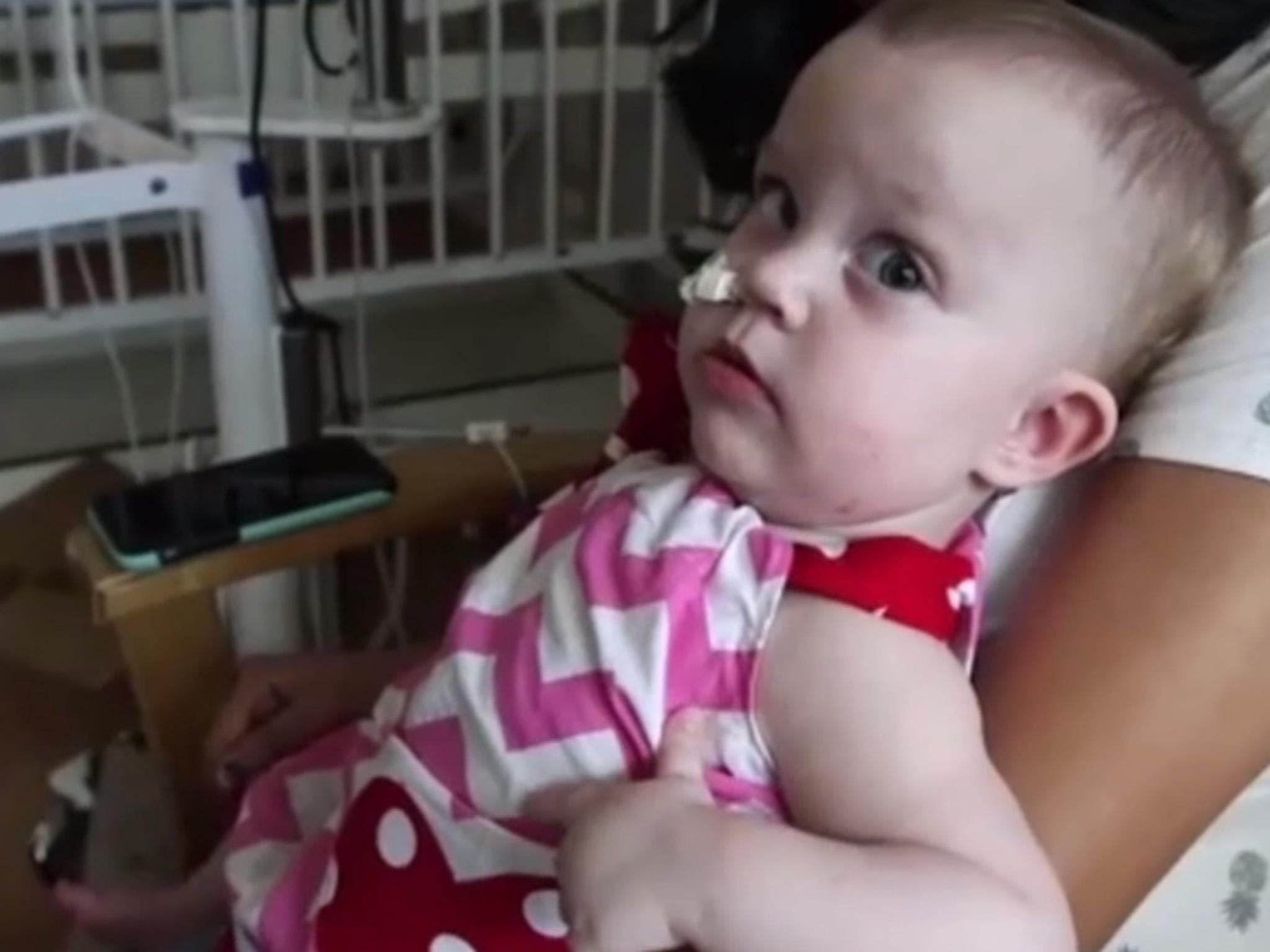 Conjoined twin discharged from hospital after 428 days