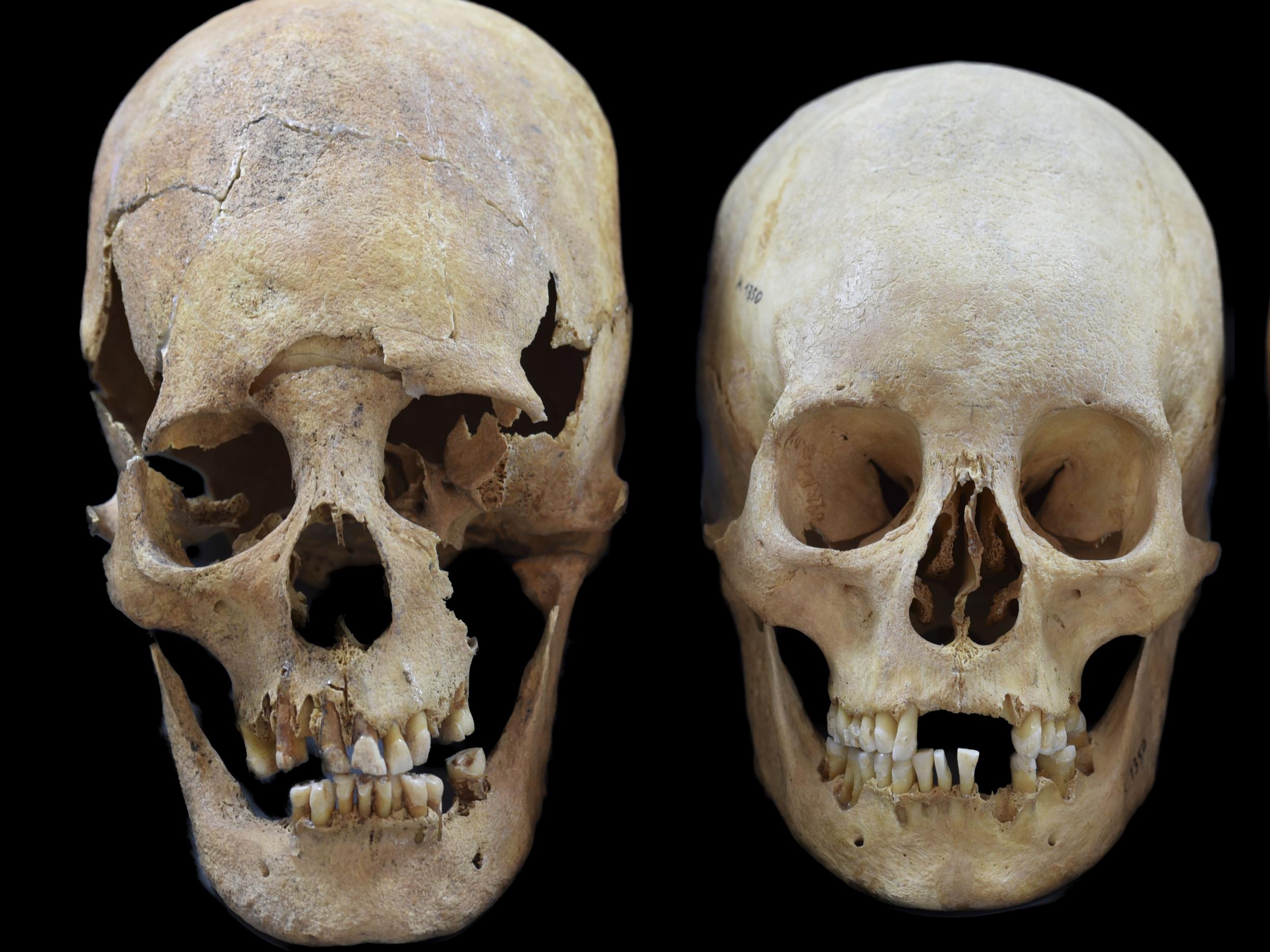 Undated photo provided by the State collection for Anthropology and Palaeoanatomy Munich shows strong and intermediate deformed skulls, from left, from the Early Medieval sites Altenerding and Straubing in Bavaria, Germany.