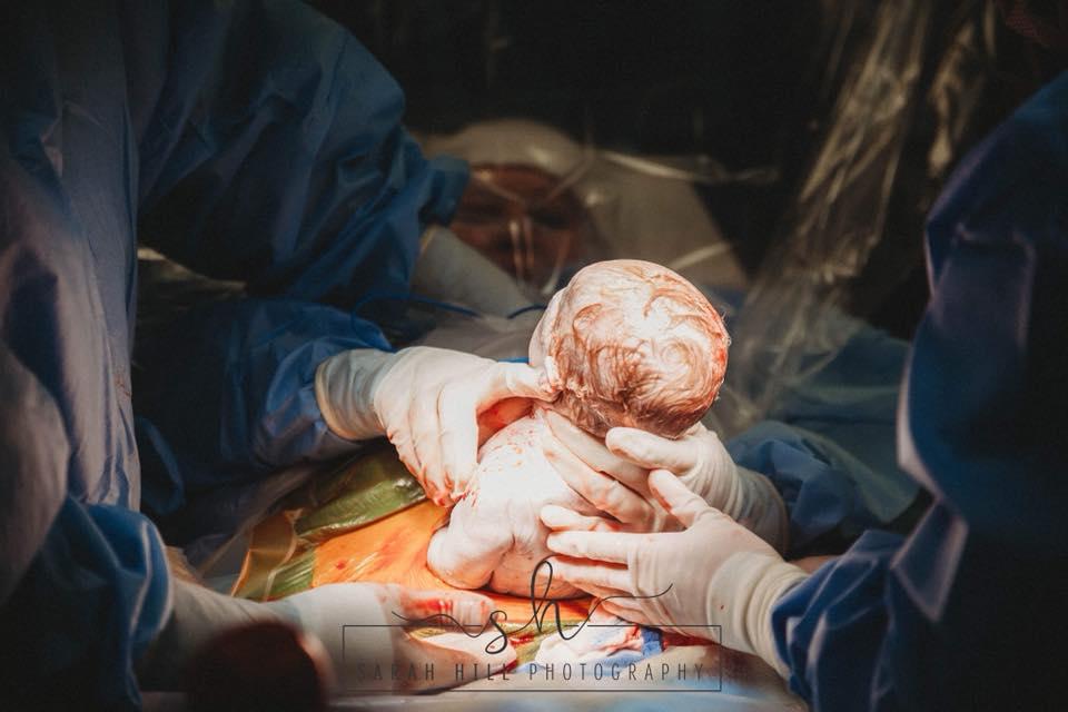 Baby Emma was born via C-section (Sarah Hill Photography)