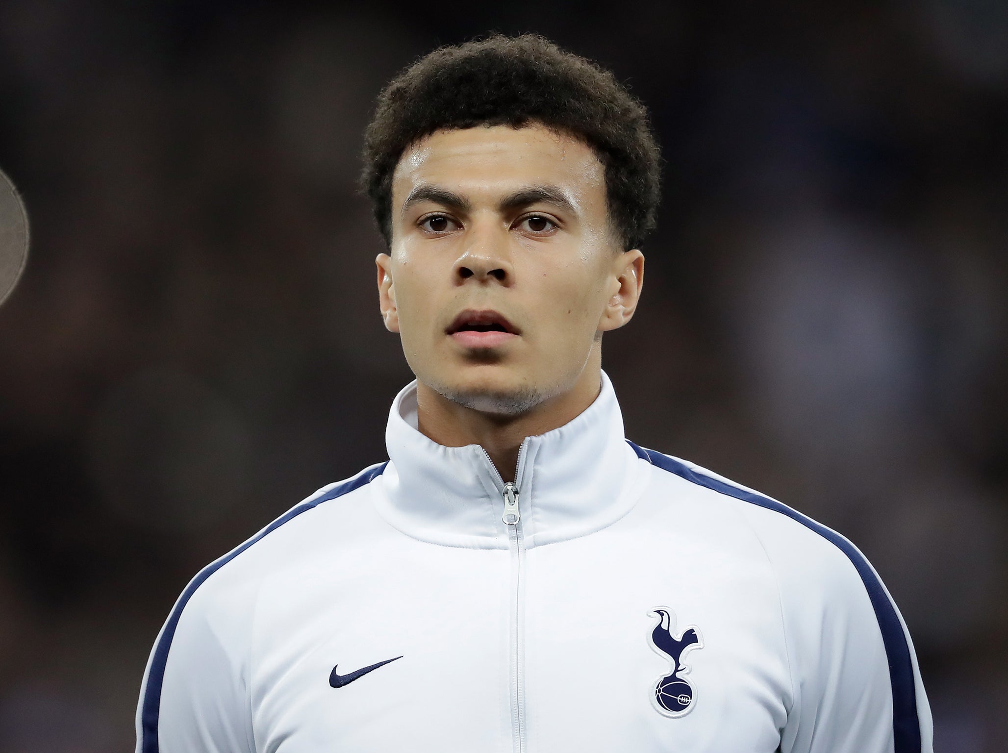 Is Dele Alli one of the best players in the world?