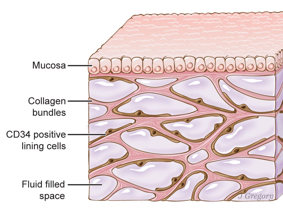 The newfound organ, here beneath the top layer of skin, is also in tissue layers lining the gut, lungs, blood vessels and muscles. The organ is a bodywide network of interconnected, fluid-filled compartments supported by a meshwork of strong, flexible proteins