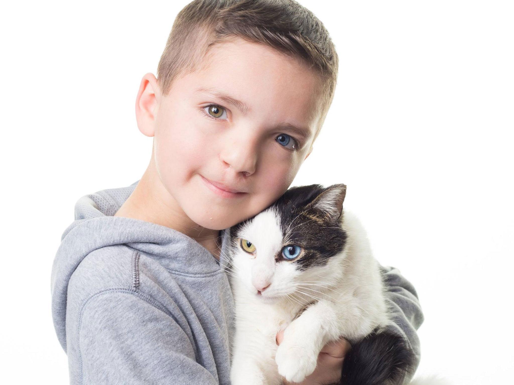 Madden Humphreys, 7, from Oklahoma, with Moon. Both have the same rare eye condition and cleft lip.