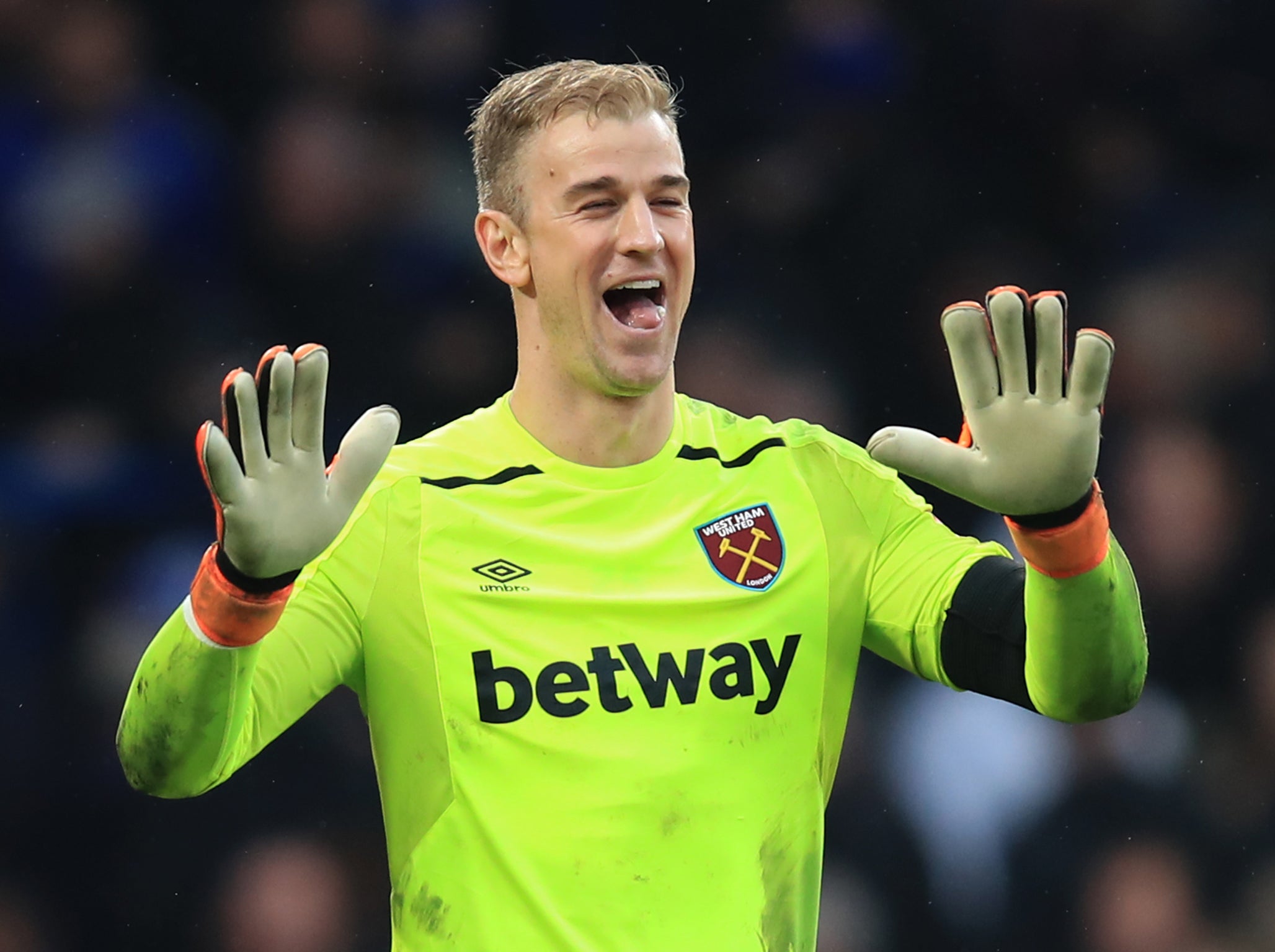 Joe Hart is feeling confident