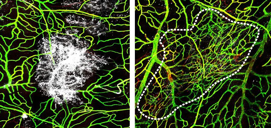 Left, white blood cells flood damaged area to clear dead cells after a concussion; right, cells rebuild lost blood vessels to maintain health of protective brain lining