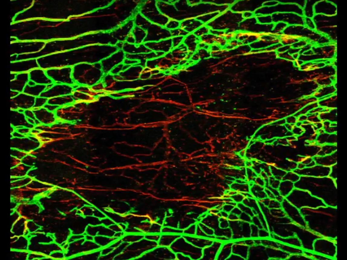 US team found that a second concussion in 24-hour period prevented normal regeneration of damaged blood vessels