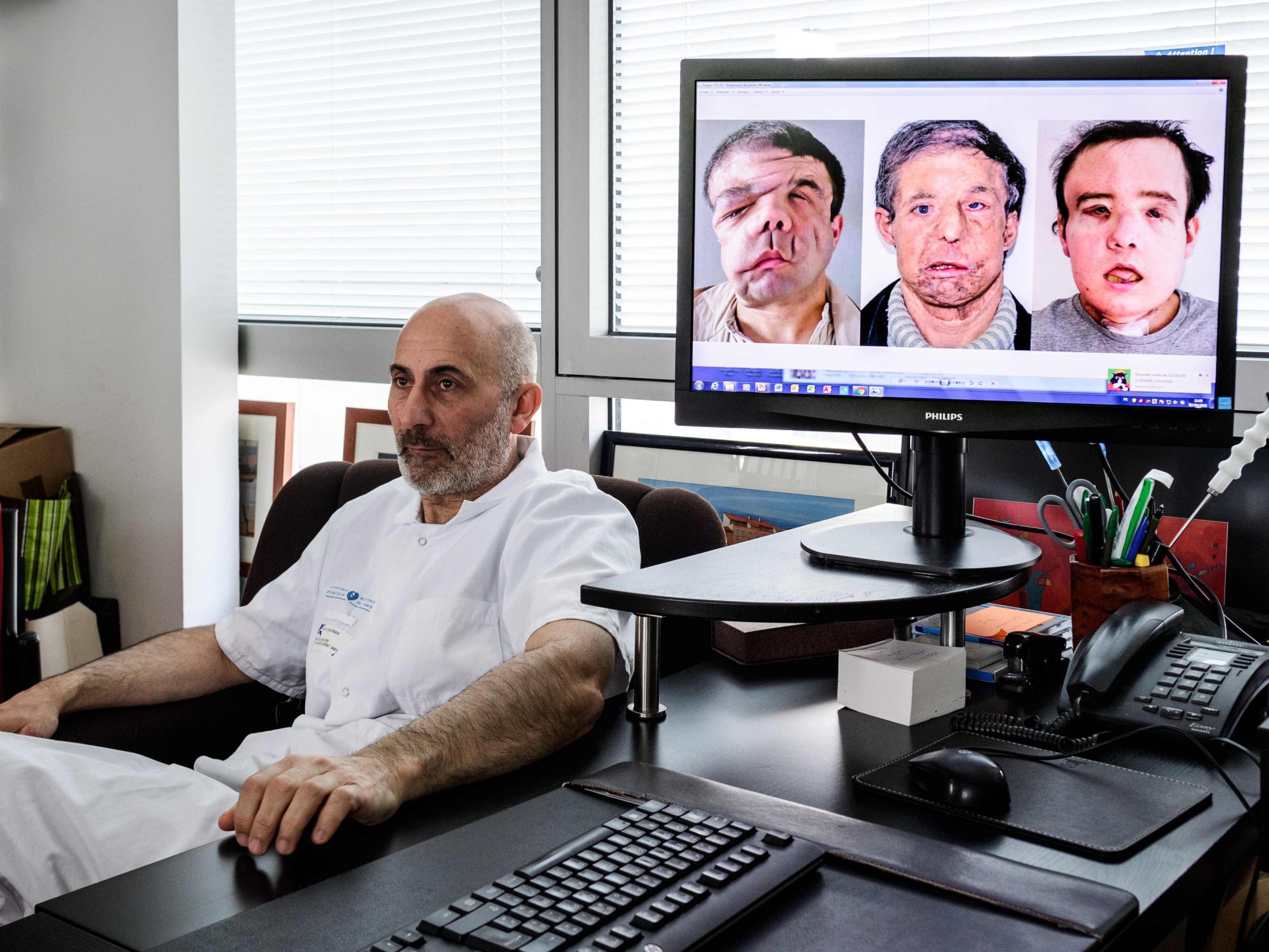 Surgeon Laurent Lantieri next to a screen showing different stages of his patient Jerome Hamon’s surgery