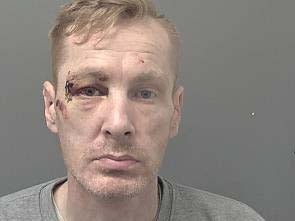 Michael Carr was knocked unconscious after a burglary in Hull