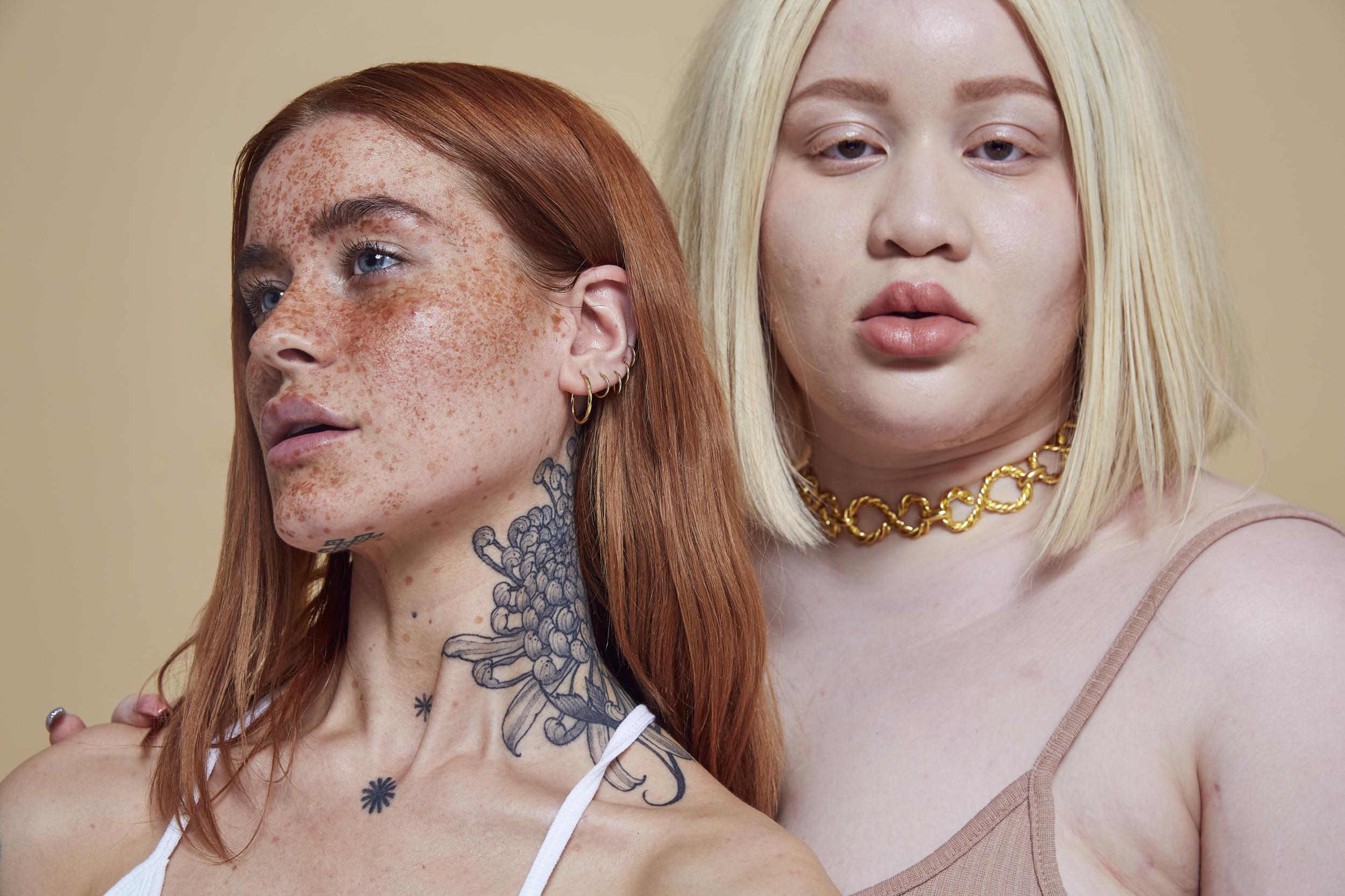 Polly poses alongside plus size model Joanne, who has albinism.