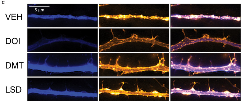 This figure shows the effects of three psychedelics, DMT, LSD, amphetamines (DOI) and one control (VEH) on neurons in the prefrontal cortex